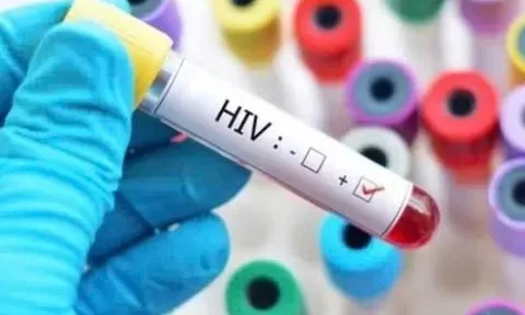Quy định mới về cấp giấy chứng nhận bị phơi nhiễm HIV do tai nạn rủi ro nghề nghiệp